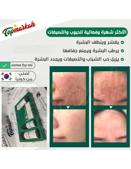 الروتين الكوري الأكثر شهر وفعالية للحبوب والتصبغات