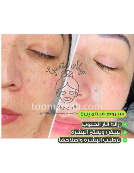 بشرة الكوريين بشرة صافية ومشرقة