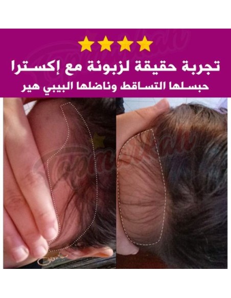 روتين اكليل الجبل اكسترا مغذي ويوقف التساقط بالأعشاب 7 السبعة  - Routine romarin EXTRA nourrissante et anti chute des cheveux